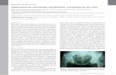 Tuberculose de articulação coxofemoral: a propósito de um caso · Figura 3 – Exame de ressonância nuclear magnética de-monstrando extensas áreas mal delimitadas de hipossinal