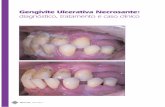 Gengivite Ulcerativa Necrosante: diagnóstico, tratamento e ...dentalface.net/images/artigos/GUN.pdf.pdf · GUN, juntamente com a Periodontite Ulcerativa Necro-sante ... deve fazer
