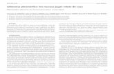 Adenoma pleomórfico em mucosa jugal: relato de casofiles.bvs.br/upload/S/0104-7914/2014/v23n65/a5033.pdf · período de 10 anos, de 1996 a 2005 em Goiás, revelou que de 599 casos