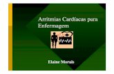 Arritmias Cardíacas para Enfermagem - ineti.med.br · Não há atividade elétrica atrial organizada, portanto, não há ondas P (ondas f) ... Desnecessário, quando sem sintomas.