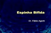 14 Espinha Bífida - Fabio Agertt's Blog · –Espasticidade de mmss ocorre em 20% –Relacionado principalmente hidrocefalia e limita muito as AVD –Hidrocefalia também altera