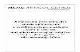 NEWS: ARTIGOS CETRUS · Análise da melhora dos sinais clínicos do envelhecimento cutâneo com o uso da intradermoterapia: análise clínica, fotográfica e ultrassonográfica