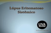 Lúpus Eritematoso Sistêmico (LES)montillo.dominiotemporario.com/doc/Lupus.pdf · São lesões eritematosas e edematosas sobre o dorso do nariz e as bochechas com tendência a poupar