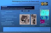 Hemangioma Cavernoso da Supra-renal · Ÿ O hemangioma cavernoso da glândula supra-renal é um tumor benigno, raro, com menos de uma centena de casos reportados na literatura. Ÿ