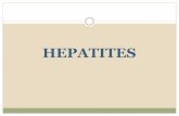 HEPATITES - Unificado Concursos - Seu futuro … .pdfComplicações: cronificação da infecção, cirrose hepática e suas complicações e carcionoma hepatocelular Tratamento: não