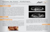 Relato de Caso - Endologix de Caso 3.pdfRelato de Caso - Endologix Tratamento da dissecção crônica da aorta descendente complicada com dilatação da artéria ilíaca direta Dr.