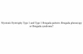 Myotonic Dystrophy Type 1 and Type 1 Brugada pattern ...fiaiweb.com/wp-content/uploads/2017/02/casos-myotonic-dystrophy... · Palpação do choque da ponta deslocado lateralmente
