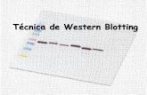 Técnica de Western Blotting - fcav.unesp.br · Alberts, Biologia Molecular da Célula 5ºedição Eletroforese SDS-PAGE .  . Soro gama IgG . Transferência para membrana