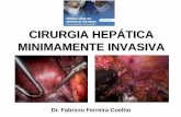 CIRURGIA HEPÁTICA MINIMAMENTE INVASIVA - cbcsp.org.br · • Proposta para ampliar a segurança e indicações da cirurgia hepática minimamente invasiva • Sensação tátil (palpação)