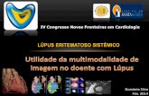 Lúpus Eritematoso Sistémico - congresso.caml-cardiologia.ptcongresso.caml-cardiologia.pt/.../2014/CNFC-2014-Doroteia-Silva-II.pdf · COLÉGIO AMERICANO DE REUMATOLOGIA (2012) 1.