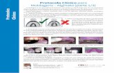 Protocolo Clínico para Moldagens – Alginato (parte 1/3) · Moldagens – Alginato (parte 1/3) A moldagem é um procedimento bastante executado na odontologia. Por ser um importante