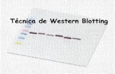 Técnica de Western Blotting · Western Blotting (Immunoblotting) Método utilizado para a imunodetecção de proteínas após sua separação por eletroforese em gel e transferência