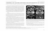 Cerebellar GlioblaStoma mutiforme in an adult · Eventhough supratentorial glioblastoma multiforme (GBM) is the most frequent primary brain tumor in adults, its localization in the