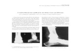 Condroblastoma epifisario de tibia (caso problema)ISSN 1515-1786 Rev. Asoc. Arg. Ortop. y Traumatol. Vol. 61, N 4, págs. 497-500 Condroblastoma epifisario de tibia (caso problema)