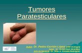 Tumores Paratesticulares › area_medica › urologia › sesiones_clinicas … · -Lipoma (66%) - Tumor adenomatoide - Leiomioma - Fibroma - Hemangioma - Neurofibroma - Mesotelioma