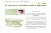 Caso XXI Ortodoncia, implantología y prótesis · Ortodoncia multidisciplinar Fig. 7, a-c: Detalle de la sonrisa después del TMD: (a) frontal, (b, c) laterales. 7a 7b 7c de que