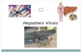 Apresentação do PowerPointvirologia.sites.uff.br/wp-content/uploads/sites/... · História natural da hepatite C Após estabelecida a cirrose, a taxa de desenvolvimento de HCC é