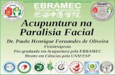 Acupuntura na Paralisia Facial - FACULDADE EBRAMEC · 2019-07-30 · Paralisia Facial Método das 3 Agulhas 3 Agulhas da Face Ta17 (Yifeng) – Em direção à orelha oposta. E4 (Dicang)
