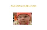 ANEMIAS CARENCIAIS - portalidea.com.br€¦ · ANEMIAS MEGALOBLÁSTICAS Anemias macrocíticas causadas por distúrbios na síntese do DNA ocasionadas por deficiência de ácido fólico
