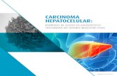 CARCINOMA HEPATOCELULAR · 2020. 6. 6. · disease), que consiste em um acúmulo prejudicial de gordura no fígado. Por ser uma doença silenciosa, assim como seus fatores de risco,