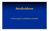 Polineuropatia amiloidótica familiarAs Polineuropatias Amiloidóticas Familiares (PAF) estão As doenças amiloidóticas englobadas nas Amiloidoses Hereditárias. Existem 4 tipos