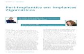 Peri-Implantite em Implantes Zigomáticos · 2019. 4. 19. · apenas parcialmente eﬁcaz; Leonhardt e colaboradores (19) descreveram o tratamento cirúrgico e antimicrobiano eﬁcaz
