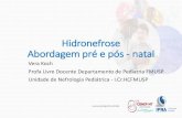Hidronefrose Abordagem pré e pós - natal...2020/02/01  · O que é hidronefrose? •Hidronefrose (HN) é a dilatação do sistema coletor renal. Quando inclui a dilatação dos