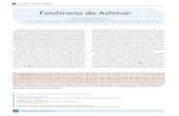 Fenômeno de Ashman - docs.bvsalud.orgdocs.bvsalud.org/biblioref/2019/06/1005089/rdt-v24n1_10-11.pdf · período refratário maior que o esquerdo, mesmo na ausência de doença do