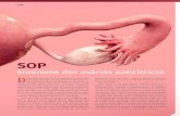 SOP - bvsalud.org€¦ · (SOP) tem se destacado como uma das desordens endó-crinas mais comuns na idade reprodutiva, e sua prevalên-cia varia de 6% a 10% em mulheres na menacme.