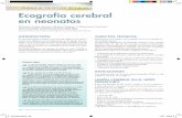 Ecografía cerebral en neonatos - elsevier.es