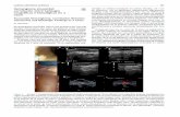 Sinusoidal Hemangioma: Correlation Between Ultrasound and ...