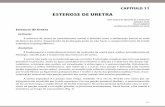 ESTENOSE DE URETRA - Urologia UERJ