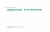 IMAGE FUSION - Brainlab