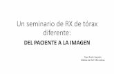 Un seminario de RX de tórax diferente